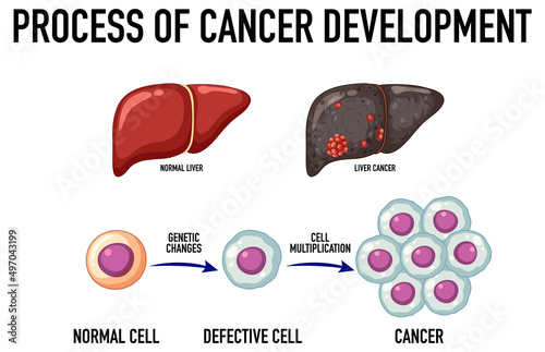 Diagram showing cancer development process