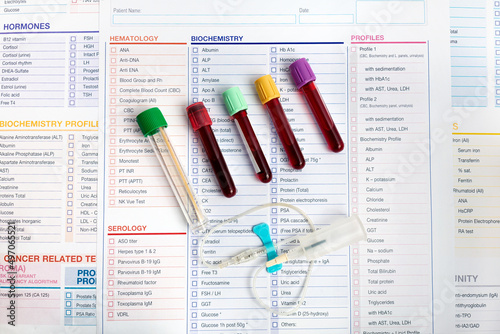 Workplace of laboratory with Blood tubes samples and requisition form for analysis in the Biochemistry laboratory. Blood samples in vacuum tubes and biological swab for examination in Biochemical lab photo