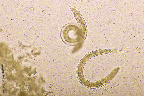 Strongyloides stercoralis or threadworm in human stool, analyze by microscope, original magnification 400x photo