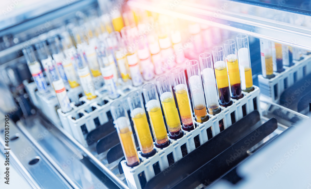 Closeup samples in robot machine for biochemical automatic testing blood laboratories Closeup samples in robot machine for biochemical automatic testing blood laboratories