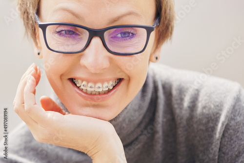 Stylish and beautiful young blonde woman in glasses and a gray sweater in braces and smiling on a white background, dentist orthodontist concept