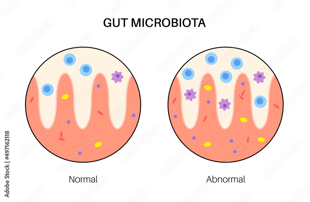 Human gut microbiota Human gut microbiota