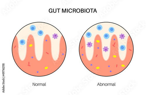 Human gut microbiota photo