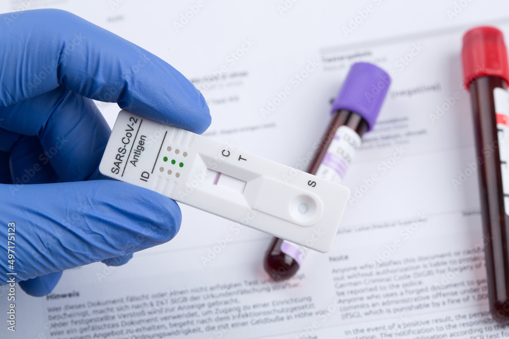 Negative test result by using rapid test device for COVID-19. Negative test result by using rapid test device for COVID-19.