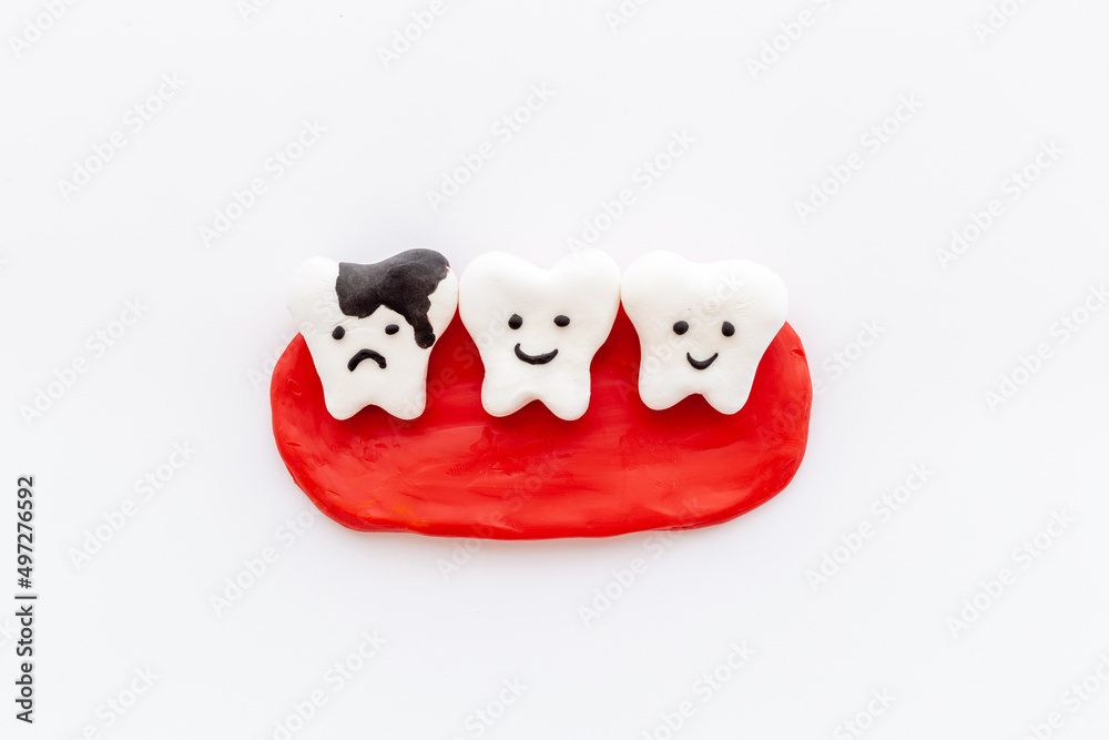 Oral health concept. Healthy and caries teeth models on gums Oral health concept. Healthy and caries teeth models on gums