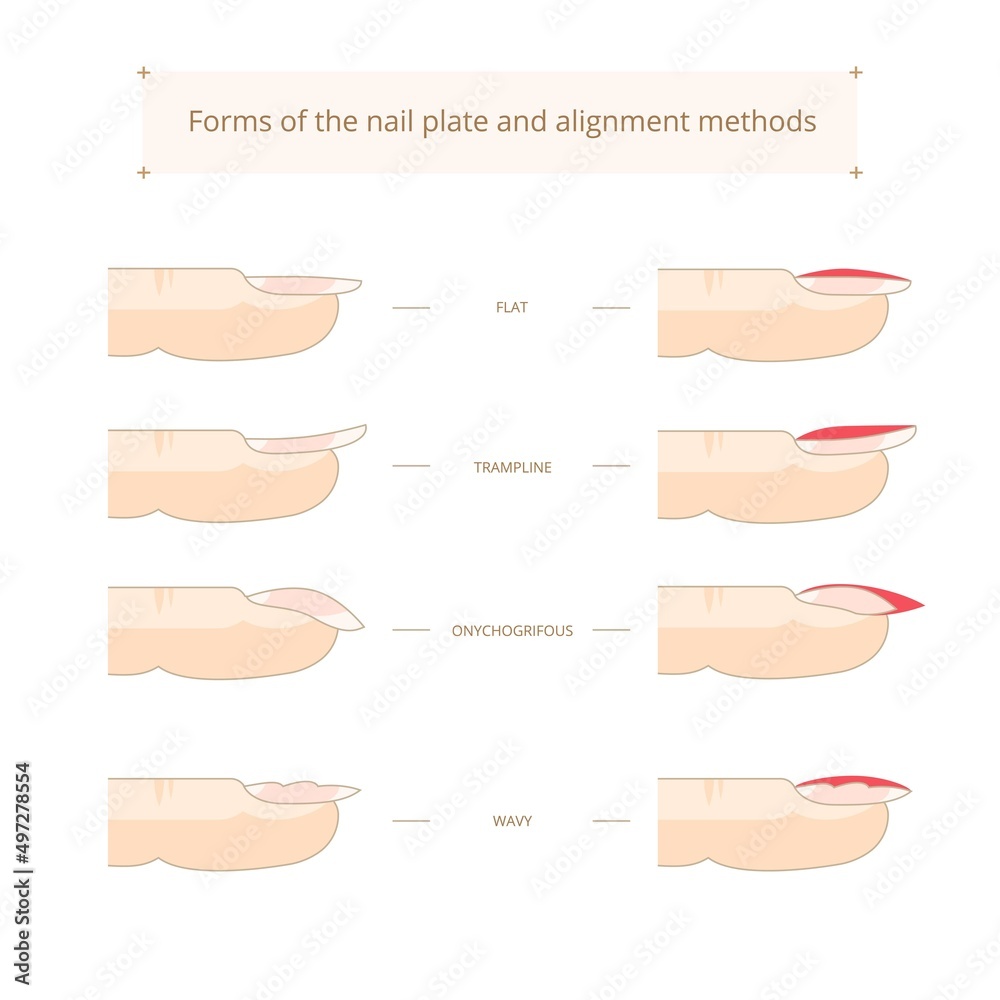 Forms of the nail plate and alignment methods. Nail shapes. Vector ...