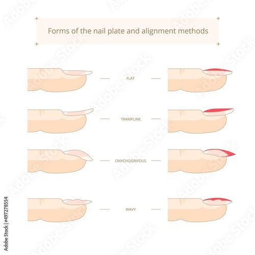 Forms of the nail plate and alignment methods. Nail shapes. Vector stock illustration