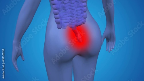The hemorrhoids pain. The red blinking on the light purple human body. Loopable. Luma matte. 3D rendering. photo