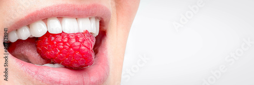 Banner perfect white smile close up, female veneer toothy smile with big red raspberry, dental care and stomatology copyspace.