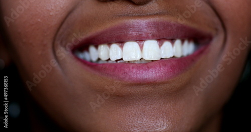Black girl mouth smiling macro close-up white teeth, african ethnicity
