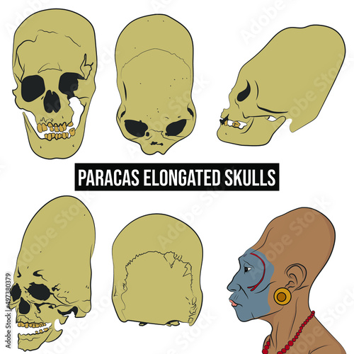 Paracas skulls, different views of skulls, paracas man side view.