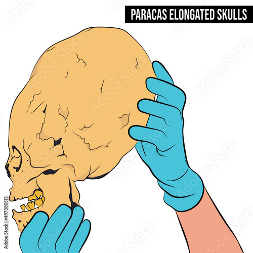 Skull Paracas, Peru, side vertical position.