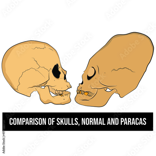 Comparison of Paracas skull and human skull. Paracas Culture - Peru. photo