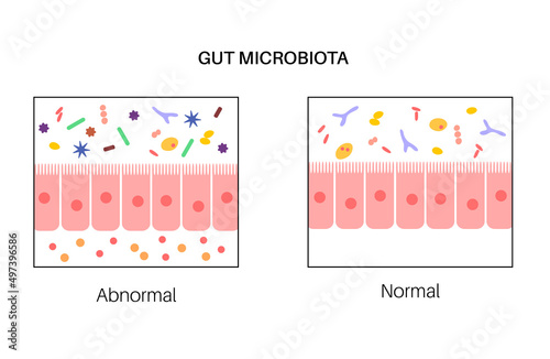 Human gut microbiota