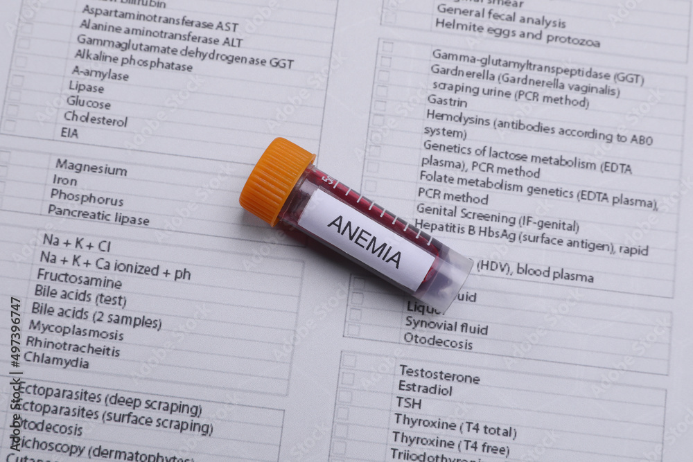 Test tube with blood sample and label Anemia on medical form, above ...