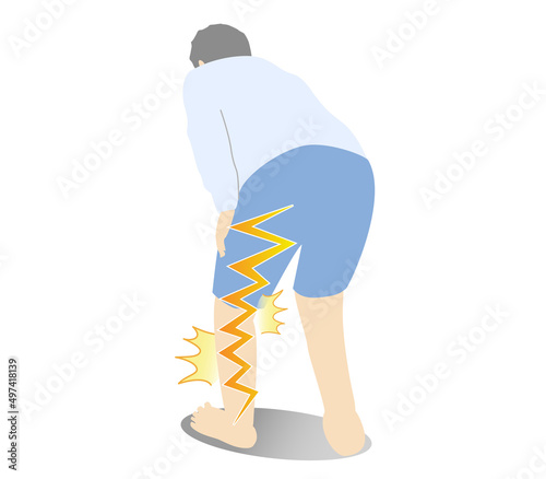 Illustration of a person suffering from sciatica photo