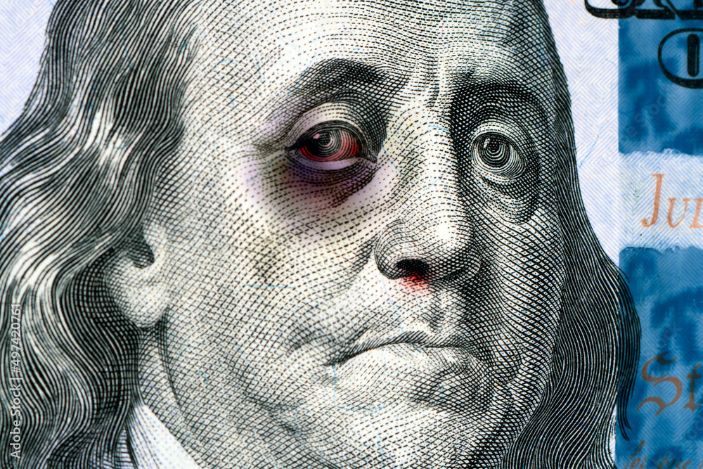 Benjamin Franklin on a 100 us bill with a black eye. The concept of the economic crisis in United States. Inflation dollar. Refusal of international dollar settlements - obrazy, fototapety, plakaty 