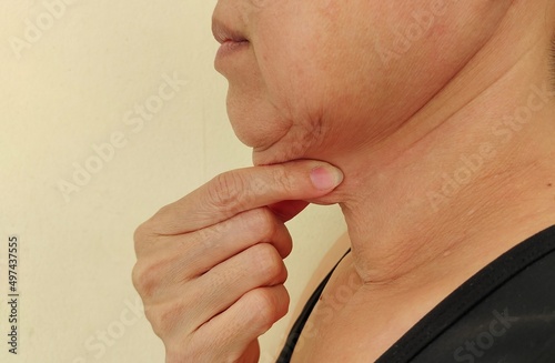 Portrait showing the fingers squeezing flabbiness adipose skin under the neck, problem double layered and wrinkled skin under the chin, concept health care.