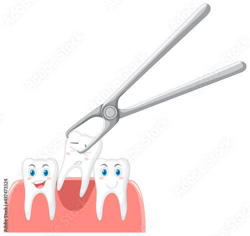 Cartoon teeth extraction on white background