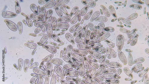 High density of unicellular paramecium  protozoa under microscope photo