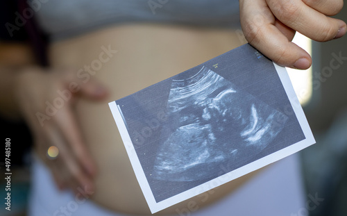 Obraz na płótnie pregnant woman is holding ultrasound picture in one hand and on the belly another hand