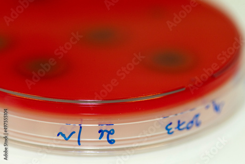 Canvas Print culture de germes en laboratoire