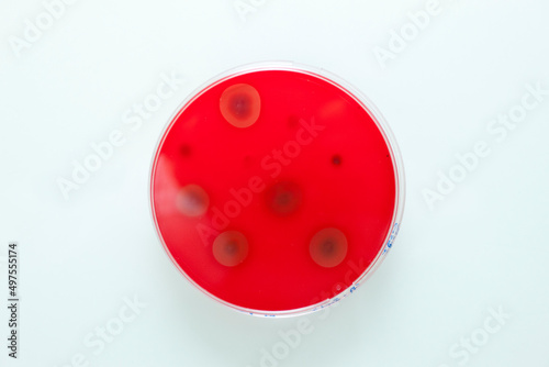 Canvas Print culture de germes en laboratoire