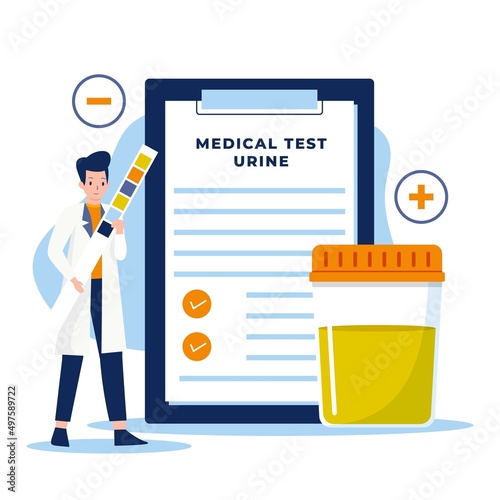 Flat design of urine test for medical and healthcare. Illustration for websites, landing pages, mobile applications, posters and banners. Trendy flat vector illustration