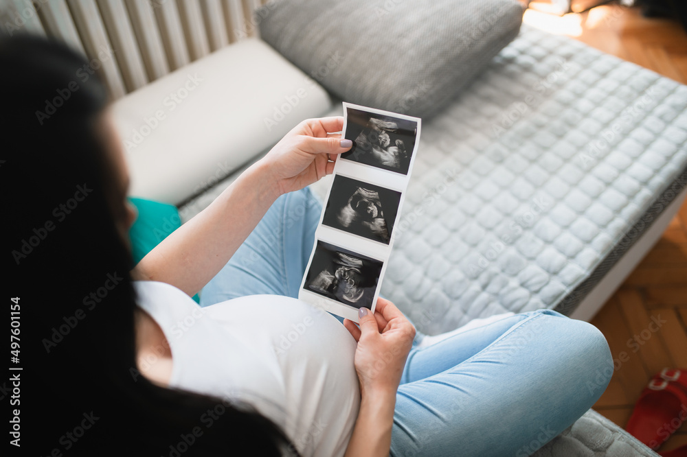 A blackhaired caucasian pregnant female looks at ultrasound baby