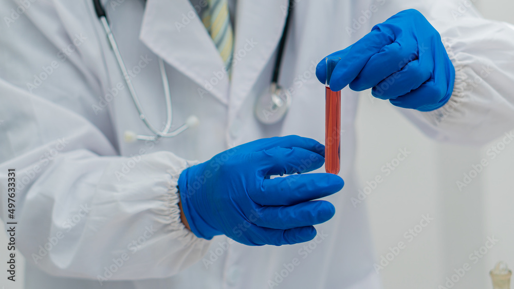 Blue gloved doctor's hand holding a bottle of blood sample in the laboratory for the study Blue gloved doctor's hand holding a bottle of blood sample in the laboratory for the study