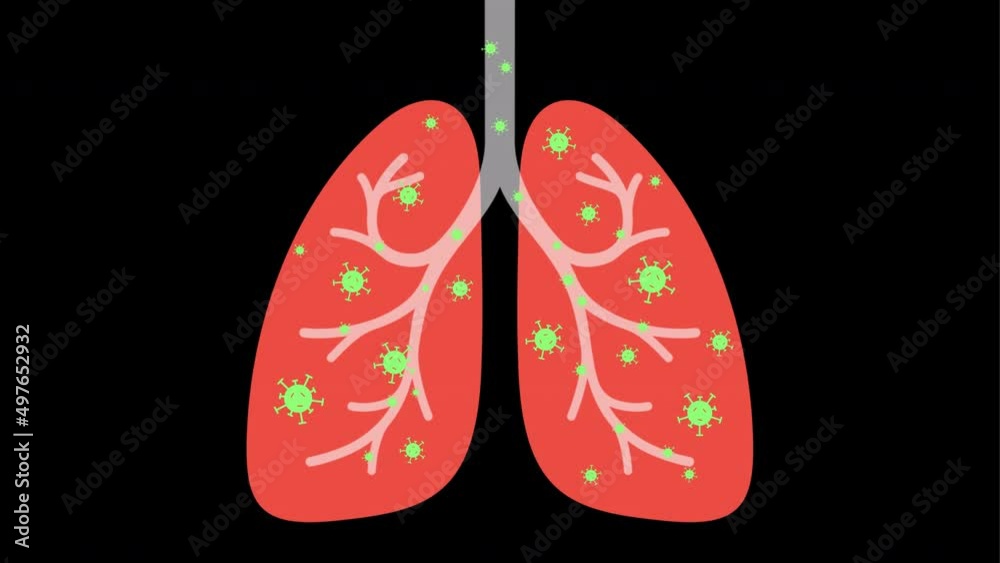 The process of coronavirus infection, MG animation , cartoon style The process of coronavirus infection, MG animation , cartoon style