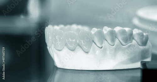 Wallpaper Mural Model of human teeth with artificial teeth close-up. Torontodigital.ca