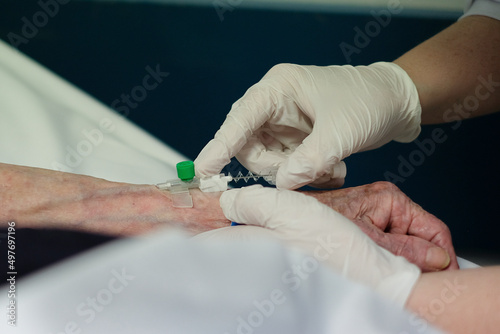 Nurse placing a venous catheter 