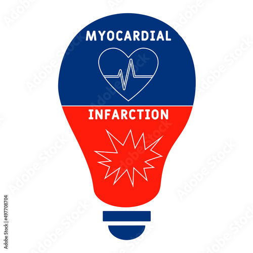 MI - Myocardial Infarction acronym. medical concept background.  vector illustration concept with keywords and icons. lettering illustration with icons for web banner, flyer, landing