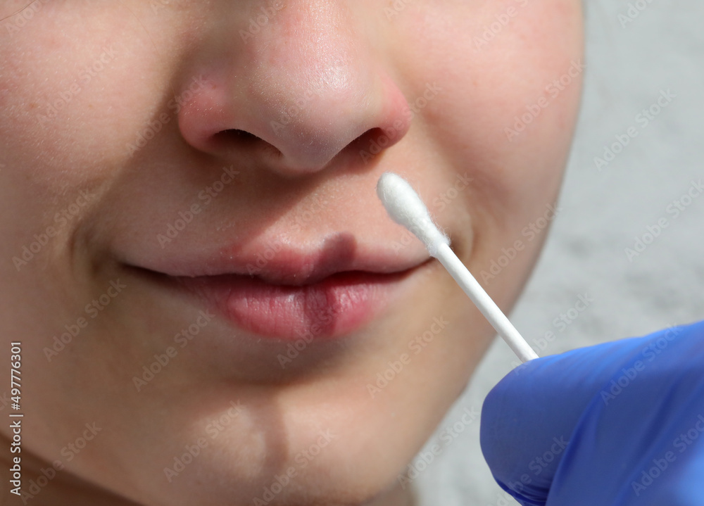Obraz premium nose of the young girl while a nasal swab test is performed for the detection of the Covid-19