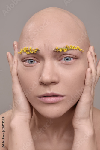 A beautiful woman without hair with flowers on her head, a conceptual photo with an unusual model