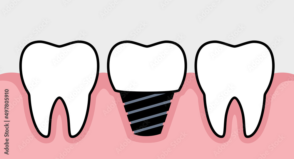 Tooth icons set. Human tooth. Symbol of doctor dentist and treatment. Isolated raster illustration on white background. Tooth icons set. Human tooth. Symbol of doctor dentist and treatment. Isolated raster illustration on white background.