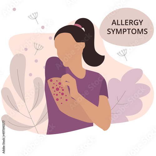 Seasonal allergy. Woman with red skin rash. Woman scratching skin on her hand