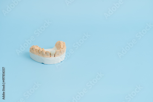 Study model of teeth and gums. On blue background. Dental concept