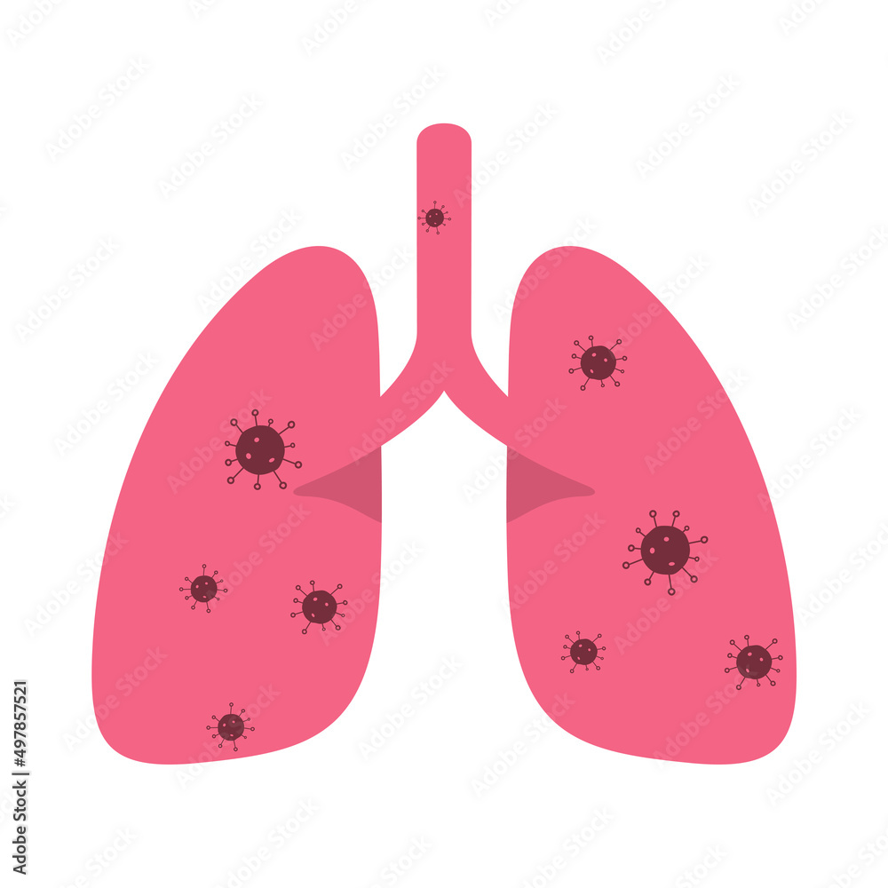 Human lungs with corona virus Human lungs with corona virus