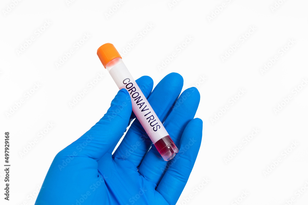 Obraz premium Hand holding blood test tube with word CORONAVIRUS