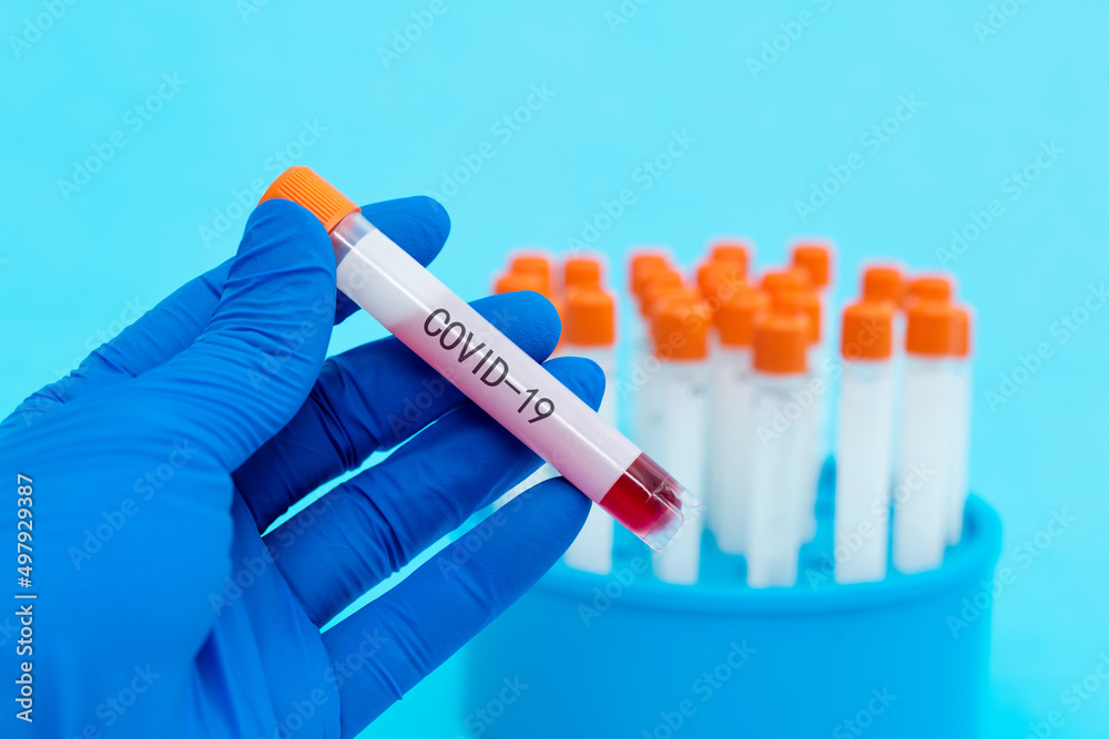 Hand holding blood test tube with word COVID-19 Hand holding blood test tube with word COVID-19