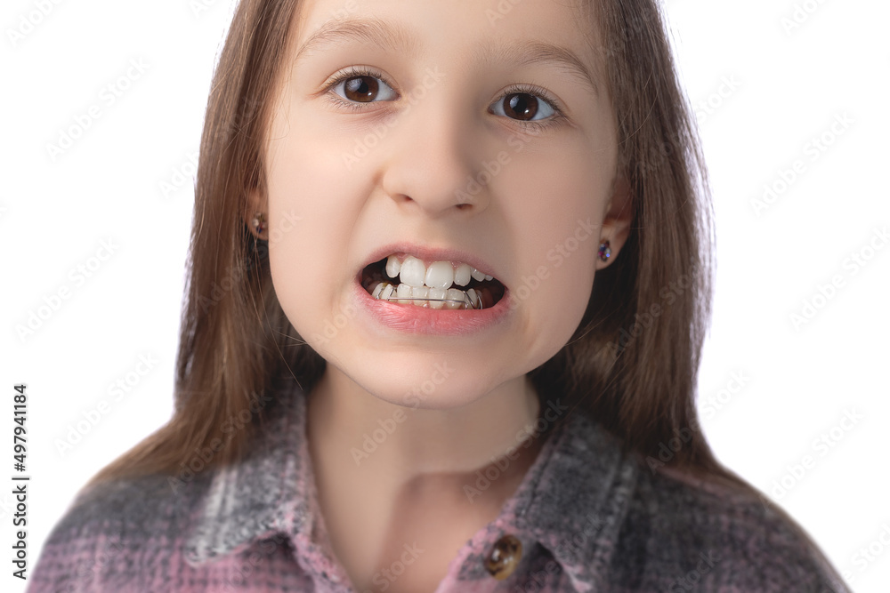 A cute little girl shows an orthodontic appliance in her mouth. The concept of teeth alignment in childhood. Studio photo on a white background.
