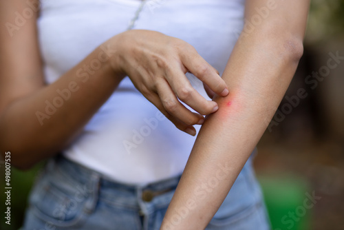 Asian woman scratching her arm skin, health care concept image of mosquito bite, allergic dermis inflammation, fungus infection, dermatology disease, malaria, dengue, tropical mosquito virus infection