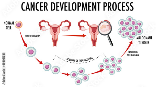 Diagram showing normal and cancer cells in human