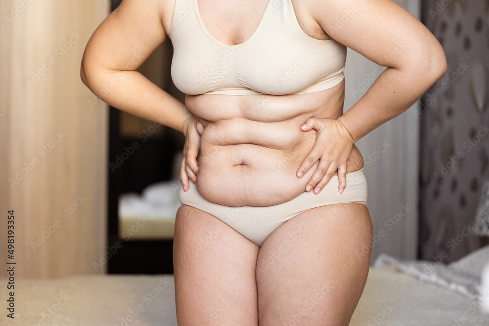 Cropped of overweight fat woman holding tummy flabs with obesity, excess fat  in underwear. Inclination body. Adipose stomach. Big size. Go on unhealthy  diet. Emphasizing excess adiposity. Excess skin Photos