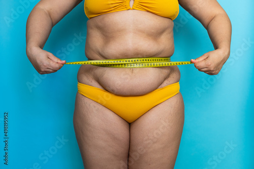 Cropped photo of plump overweight woman standing in yellow bra, swimming trunks, showing excess naked belly, tightening waist with tape. Body positive, cellulite, obesity, weight control, liposuction.