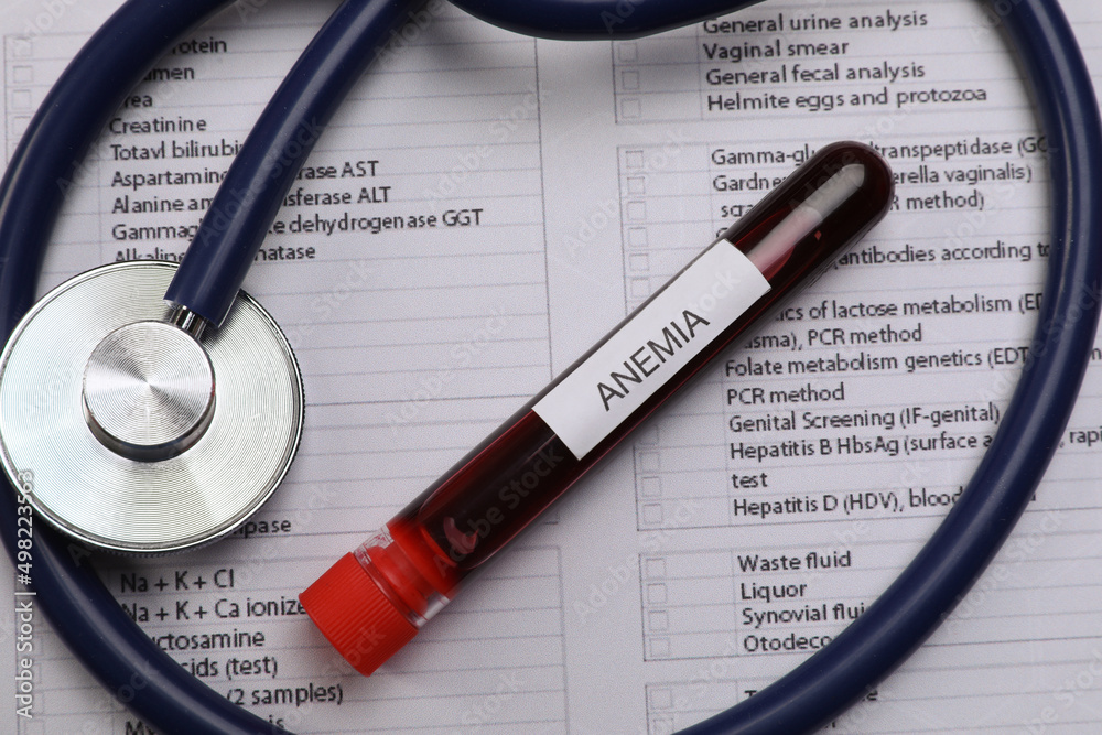 Test tube with blood sample and stethoscope on medical form, flat lay. Anemia concept Test tube with blood sample and stethoscope on medical form, flat lay. Anemia concept