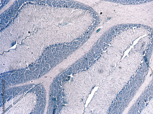 Photography Cross section of a cerebellum
