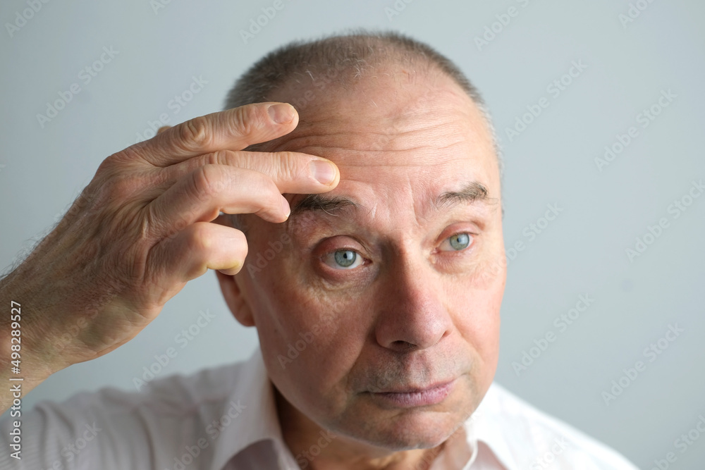 Obraz premium close-up of face of bald mature man 60 years old looks in mirror, critically examines face, skin, wrinkles, upset because age-related changes, midlife crisis, hair loss, selective focus